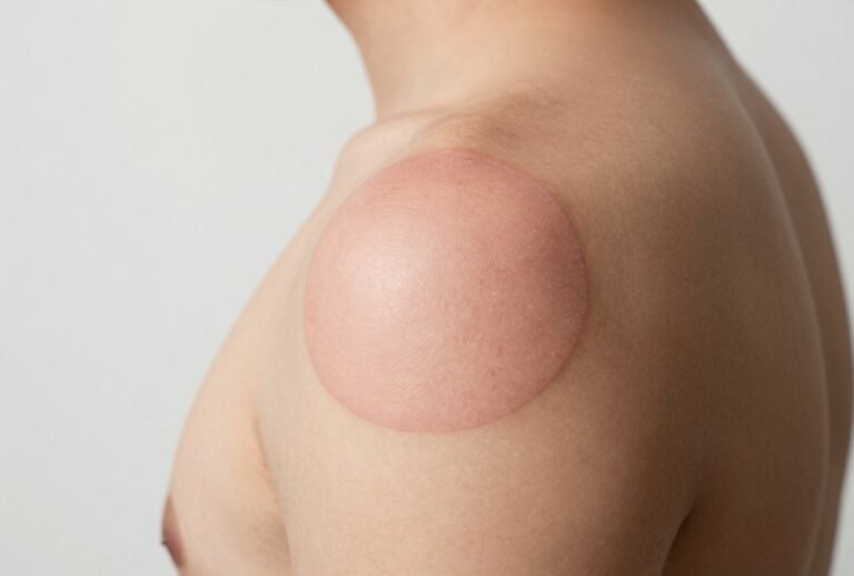 How Effective Is Tattoo Removal? A Realistic Guide
