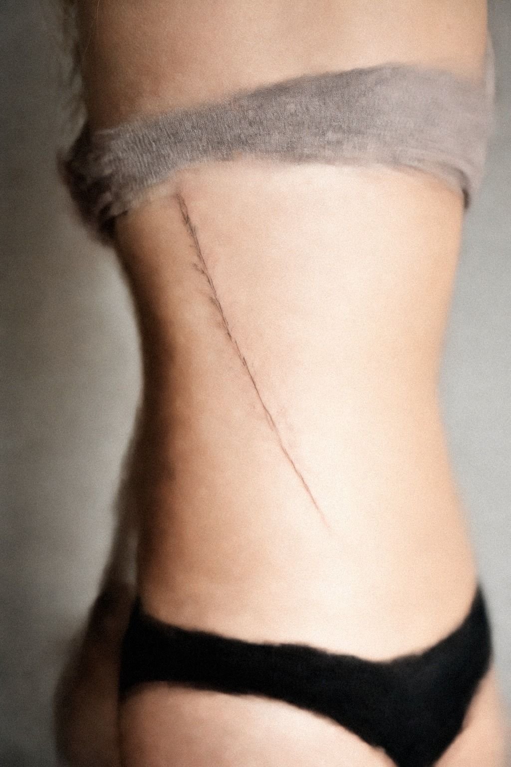 I Checked How The Rib Placement Would Hurt