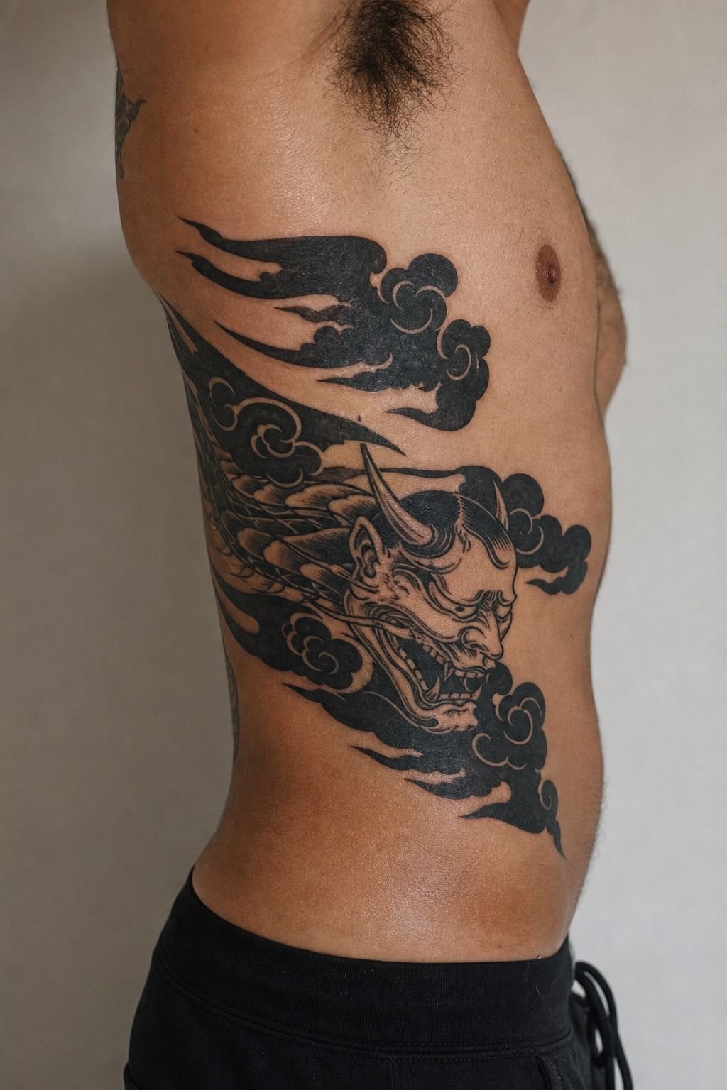 Ask About Pain On Heavy Fill