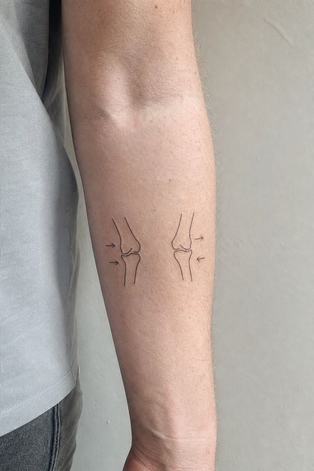 Match pain expectations to inner versus outer knee