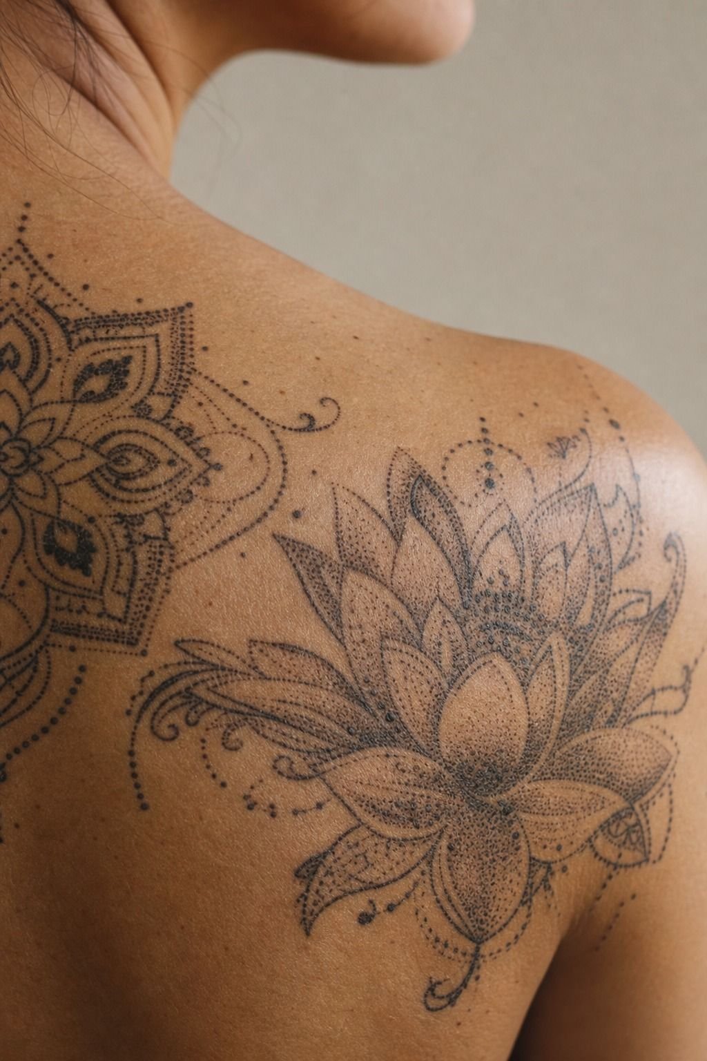 I Chose Skin Placement Before Pattern Size