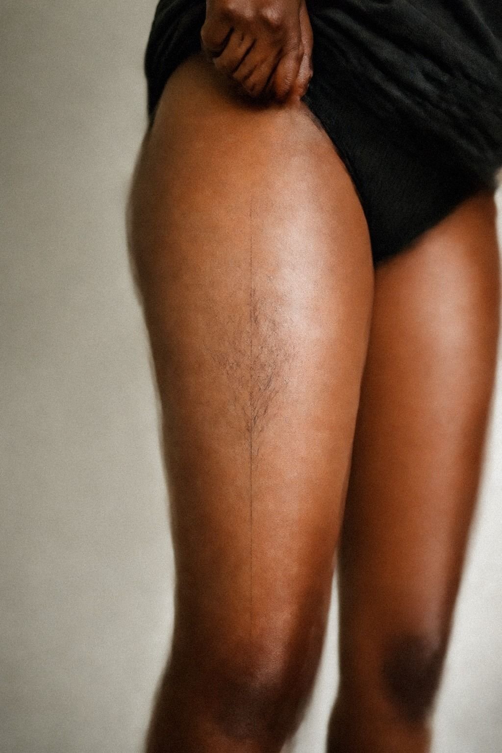 I Checked Pain Near The Inner Thigh