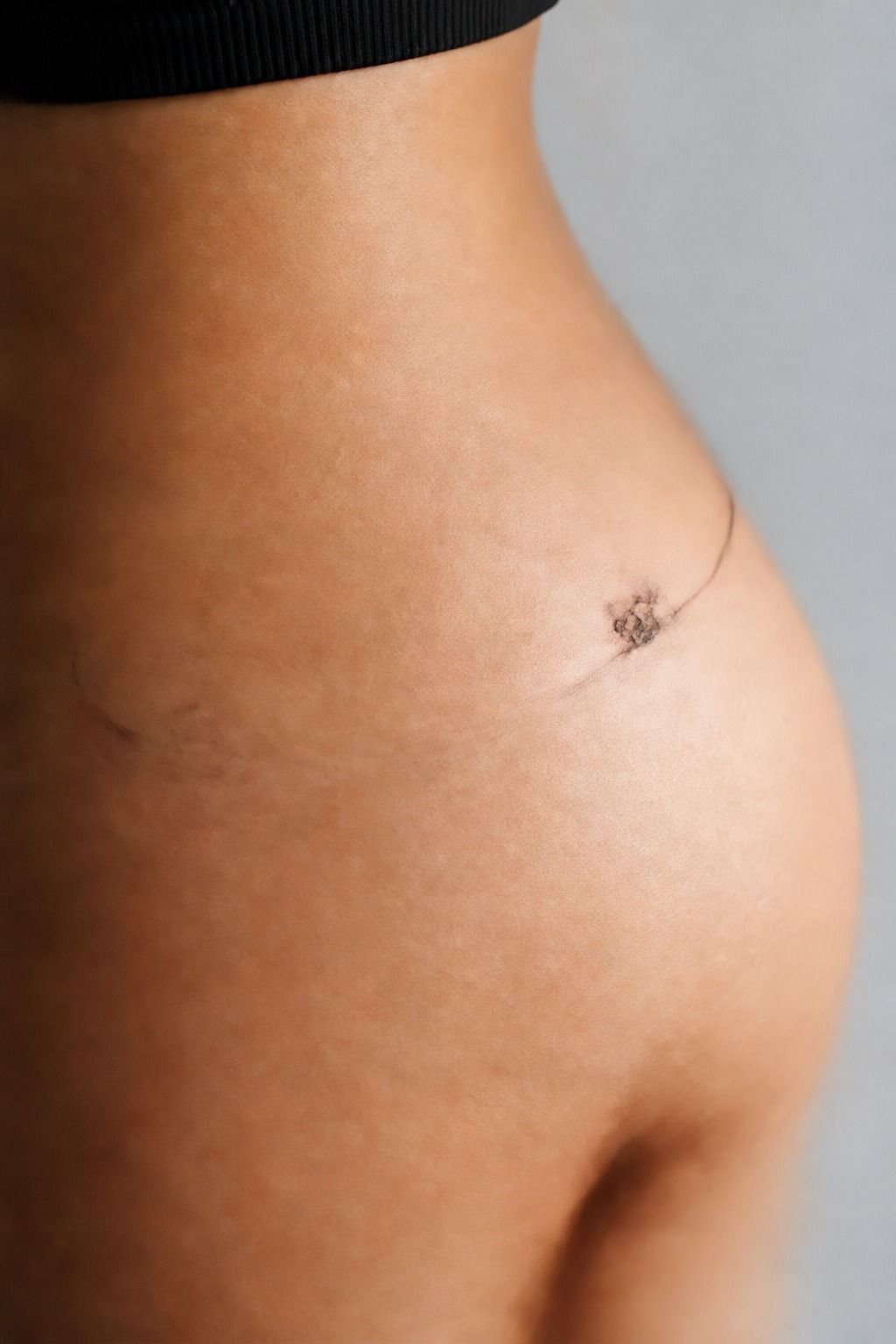 Micro Ladybug Near the Hip