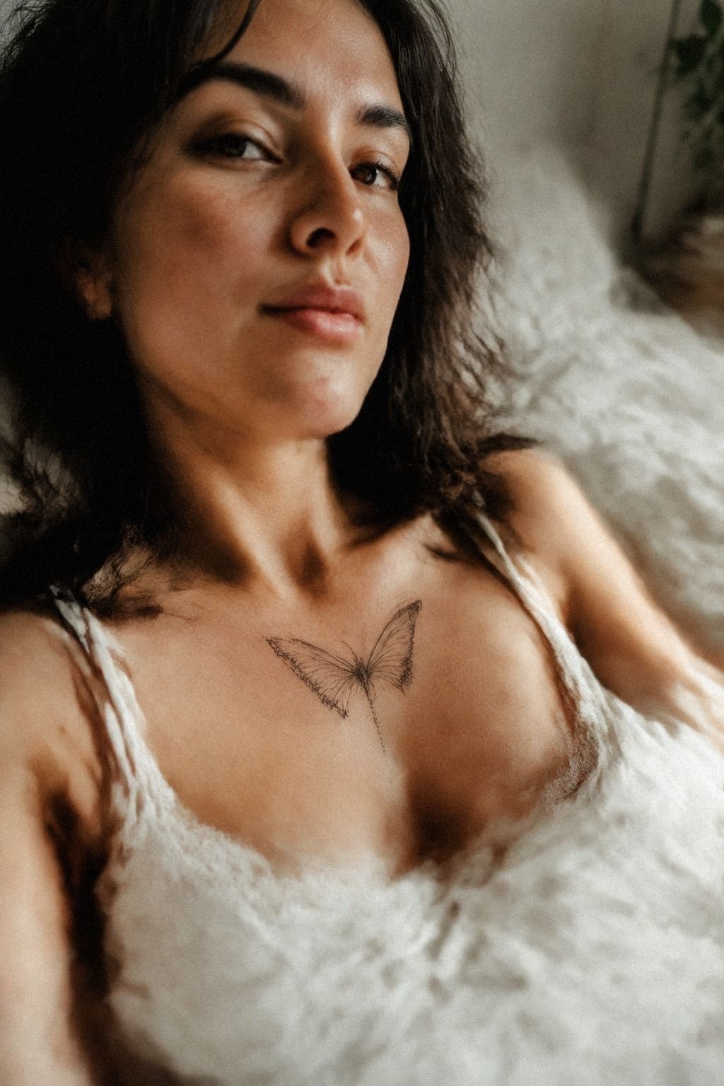Should a Sternum Butterfly Stay Minimal?